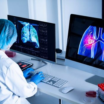 דלקת ריאות ויראלית